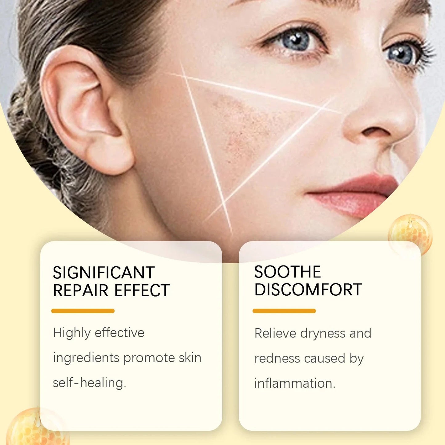 Bee Venom Skin Repair Cream – Redness & Blemish Care