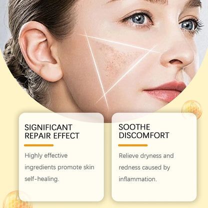 Bee Venom Skin Repair Cream – Redness & Blemish Care